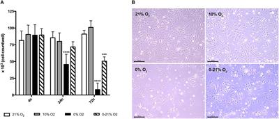 Intermittent Hypoxia Activates Duration-Dependent Protective and Injurious Mechanisms in Mouse Lung Endothelial Cells